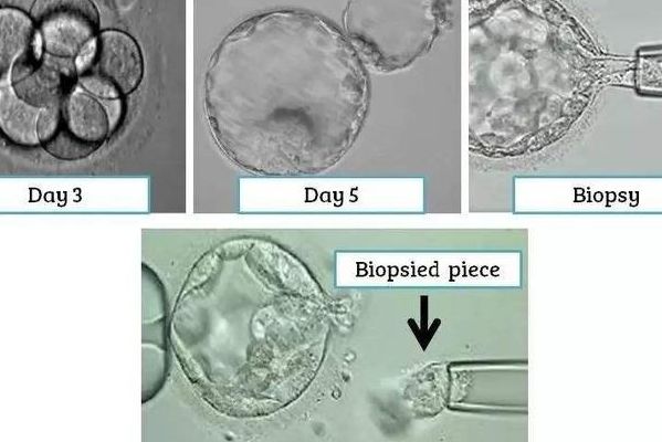 二代试管一般几次成功？32岁过来人说点大实话