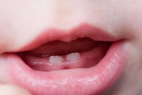 三个月大的男孩长牙齿