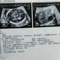 孕囊三个值区分男女对照表有人能分享一下吗?