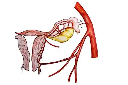 子宫动脉血流是什么意思，什么情况下要检查子宫动脉血流