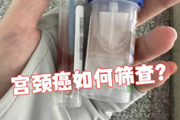 lct和tct检查在处理样本的方式有差异