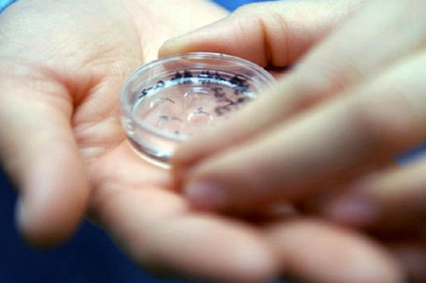 年轻女性可选鲜胚移植