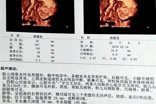 男孩的心率比较快