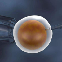 做试管移植后囊胚冷冻几个合适,移植冷冻囊胚流程难不难？