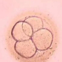 鲜胚移植成功率高吗？专家揭秘关键因素