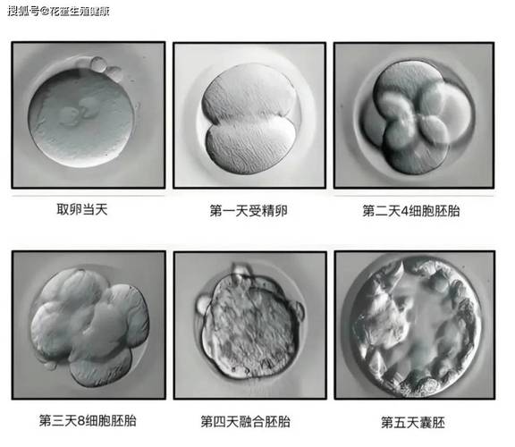 试管婴儿医院选择、生殖中心资质审核、试管医疗安全、正规试管机构鉴别