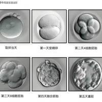 试管婴儿医院选择、生殖中心资质审核、试管医疗安全、正规试管机构鉴别