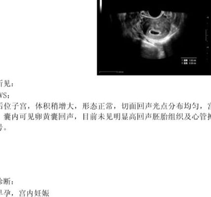 子宫三角形会不会影响宝宝_正常解剖PK异常信号，先看报告这行字