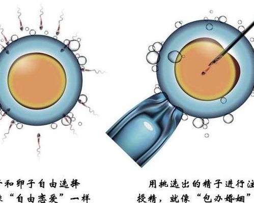 试管婴儿不是自己亲生的吗,我38岁做完才敢说真话