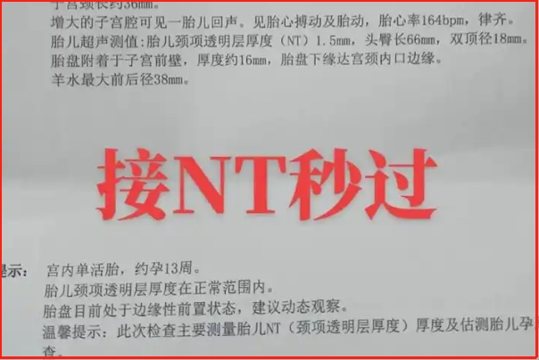 nt值1.8mm在正常范围内