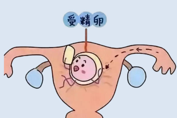 试管移植后胚胎还是孕囊