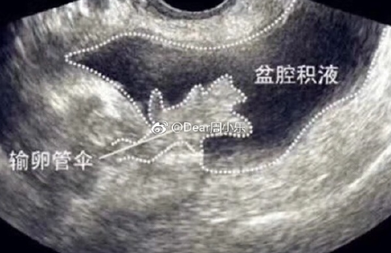 上海医院供卵代生子上海可以包成功的试管婴儿医院有哪些上海十大试管医院排名