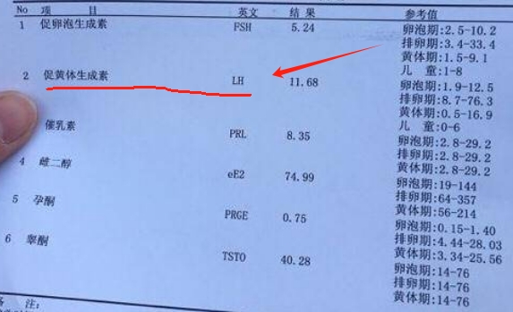 lh偏高对促排卵有影响