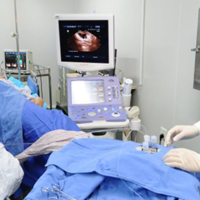 试管短方案是不是要囊胚冷冻才能移植?