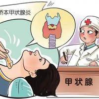 10个人9个桥本甲状腺?&zwnj;生活方式的规律性很重要