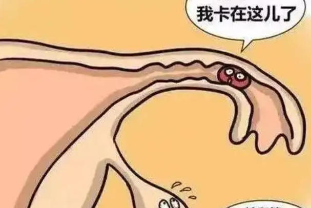 输卵管堵塞的10个征兆，最直接的后果是导致不孕