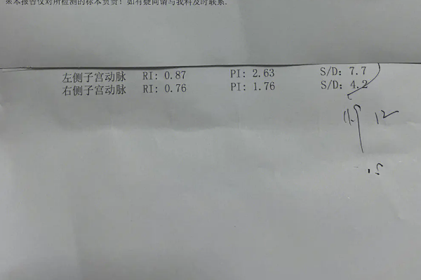 子宫动脉阻力正常数值是0.85