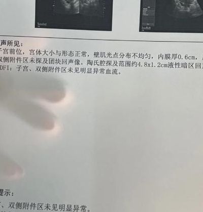 孕早期有积液会影响胚胎吗？试管移植后查出积液，我的真实经历