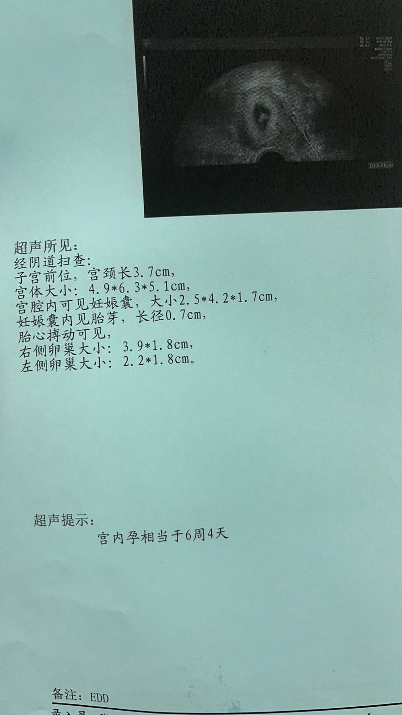 上海代生要花多少钱,(上海试管代生)国内做试管代生机构排名附详细介绍