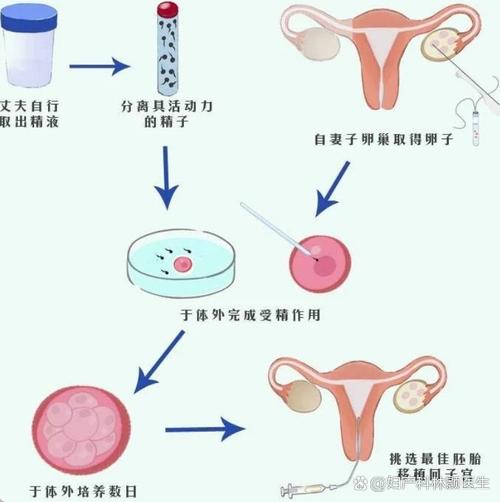 年龄是影响试管婴儿成功率的重要原因吗对吗，我32岁做试管的真实经历