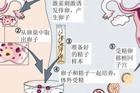 做试管四川比较好的医院是哪家？我靠5个判断维度筛