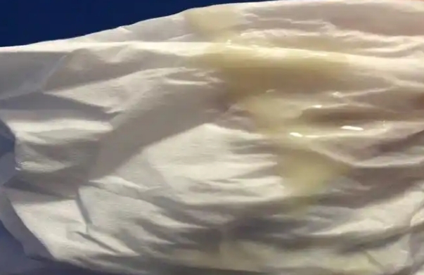 排卵过后有白带着床了