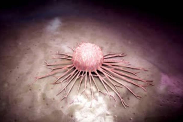 试管婴儿不会增加患神经母细胞瘤风险