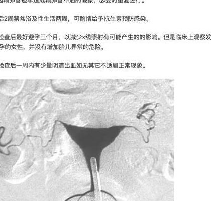 输卵管造影后多久能要小宝宝，5个判断维度让你心里有底