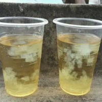 酒精验尿测男女要怎么测准确率才高?