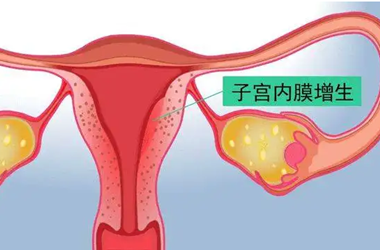 子宫内膜增生对做试管有影响吗?