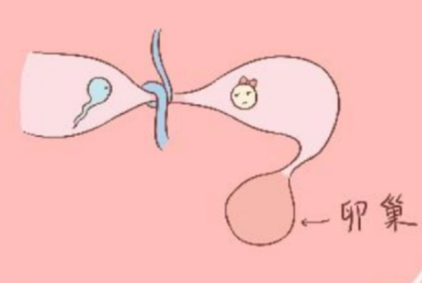 输卵管的破坏程度较小可进行疏通