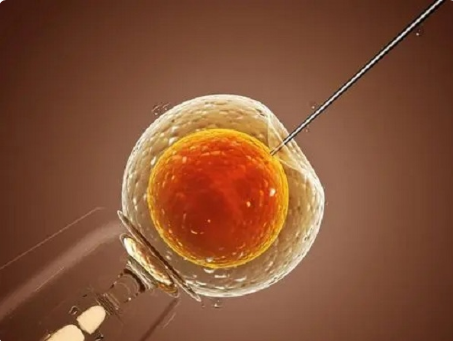 单卵双胎试管成功案例分析，与多种因素有关