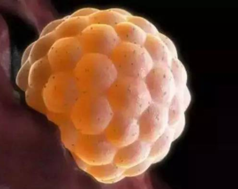 多囊取卵胚胎质量由什么决定