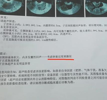 试管什么时候去检查较合适？先分清这3个时间点再进周