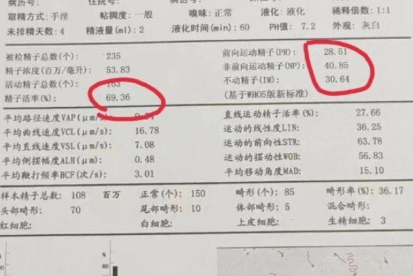 重度弱精可以做试管婴儿