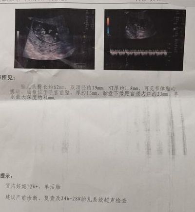 试管进周期需要天天去医院吗？我提前请了两个月假，结果白请了