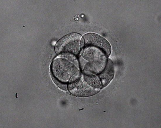 移植8细胞一级胚胎成功率高
