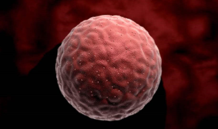 巧克力囊肿根据大小具体情况分析