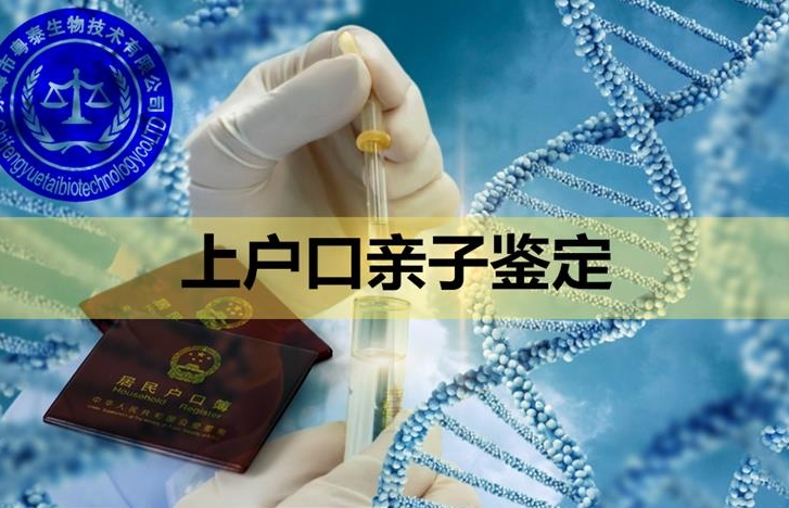 上户口是否需要亲子鉴定