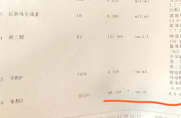 良好的生活方式可以让睾酮降下来