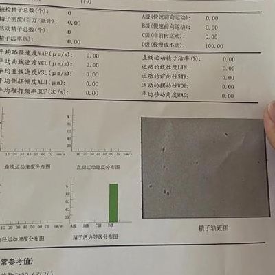 男人死精是什么样子？我靠这5个判断维度避开试管坑