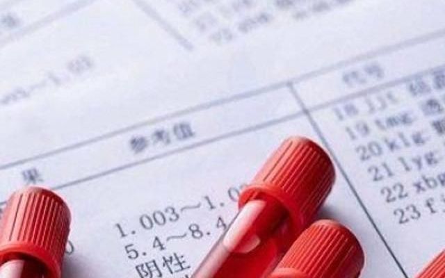 打算试管排名靠前次检查什么时候去？不是月经干净后