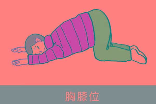 膝胸位的正确趴法是怎样的，有图片吗？