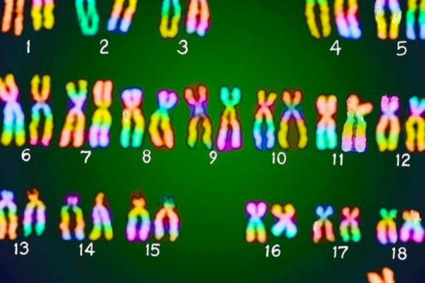 211813染色体是指什么，都属于三体综合征