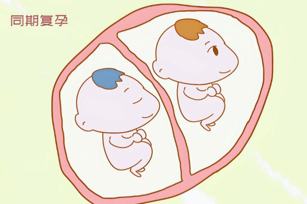 遗传因素有会影响龙凤胎的概率