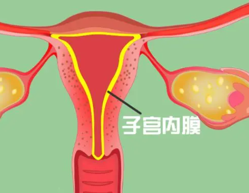 试管冻胚移植前发现是薄型子宫内膜还能着床吗？