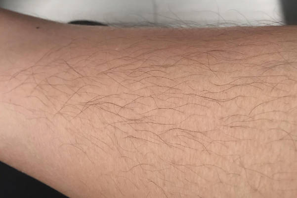 肚皮上出现毛发是怀男孩