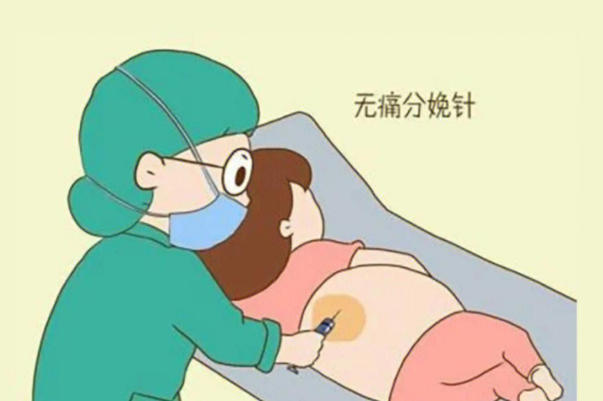 无痛分娩并非全程一点感觉都没有