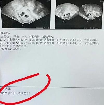 南京哪边做试管婴儿好，别只盯着成功率数字看