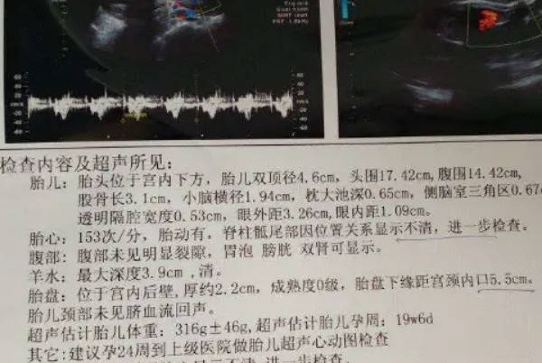 长和宽是厚度的两倍怀男宝